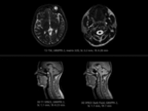Mozak,glava,vrat